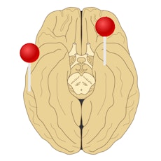 Brain illustrations with pins