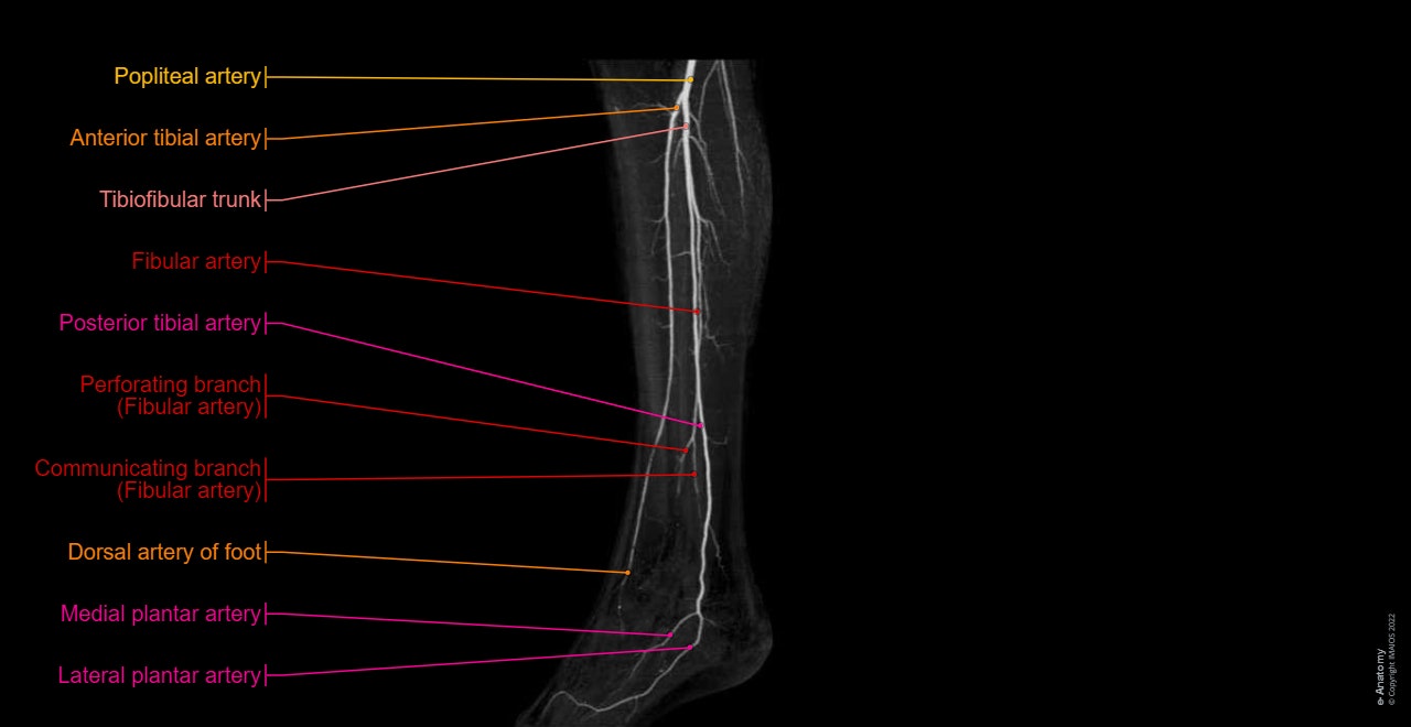 Arteries and bones of the lower limb: Interactive atlas of human