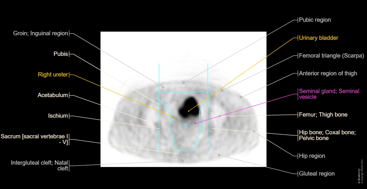 Positron emission tomography: Pelvis - Urinary bladder