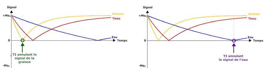 illustration Signal suppression in inversion-recovery