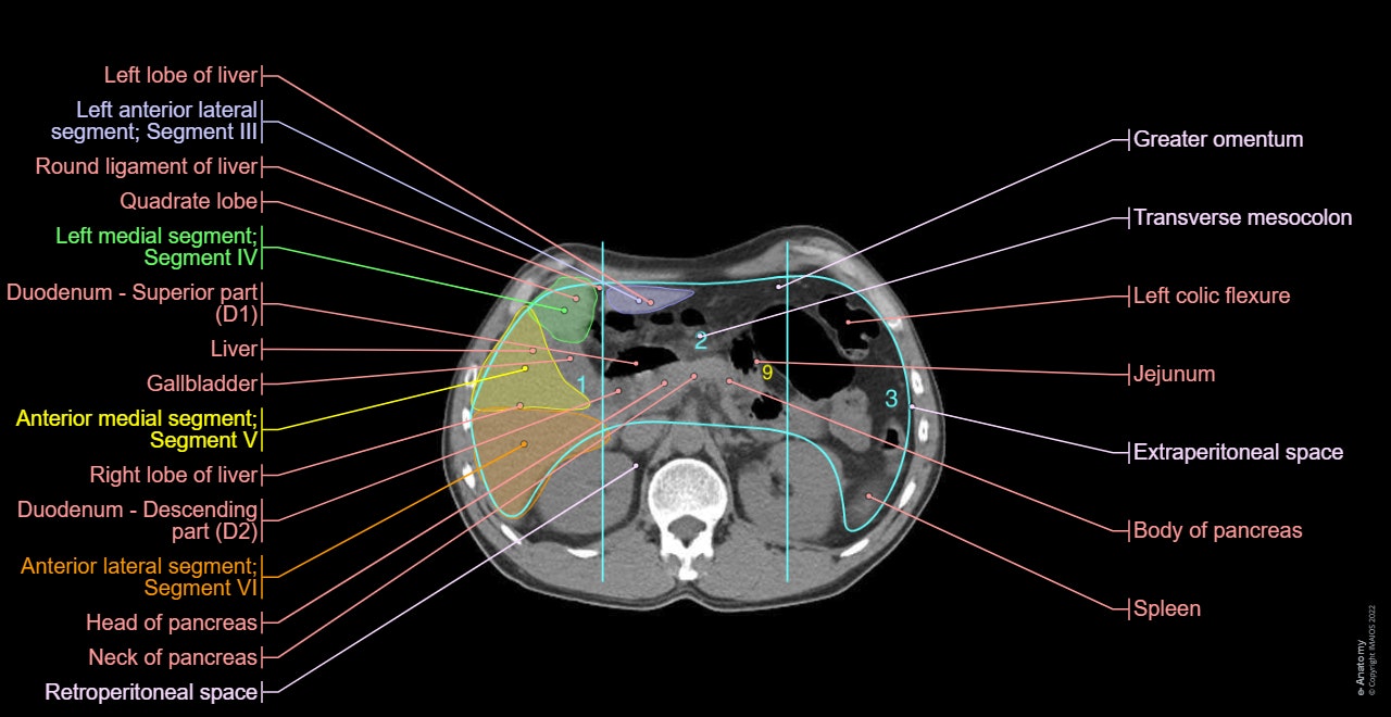 PET-CT fusion images: Hepatic segmentation - Peritoneal Cancer Index