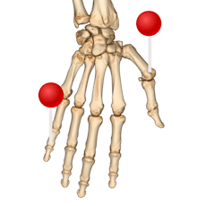 anatomical illustration of the hand with pins