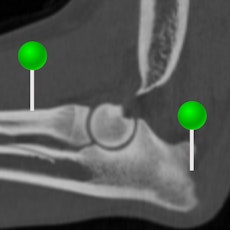 Dog - Elbow CT with pins