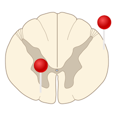 spinal cord diagram with pins