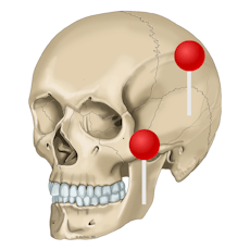 Crâne Illustrations avec épingles