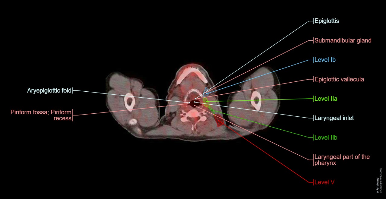 PET-CT : anatomy of the neck, thorax, abdomen and pelvis