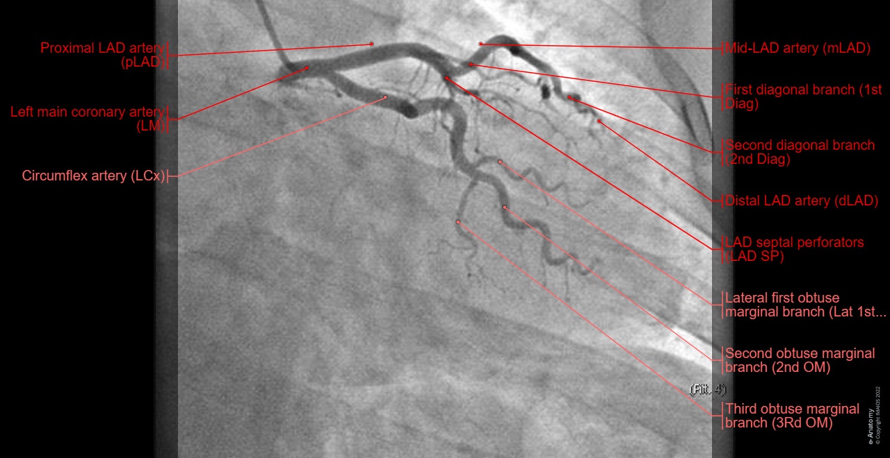 Coronary angiography : Coronary arteries - Anatomy