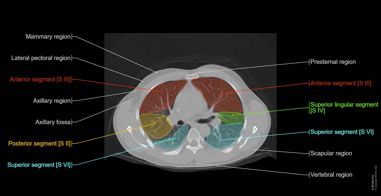 Positron emission tomography with Computed Tomography (PET-CT): Bronchopulmonary segments