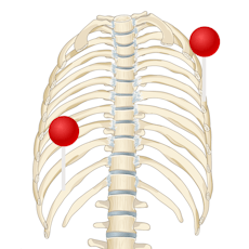 Thoracic wall-Breast illustration with pins