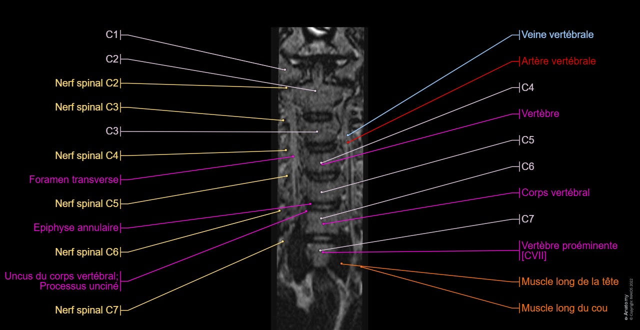 rachis cervical IRM : anatomie normale | e-Anatomy