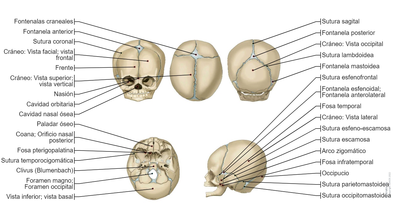 Cráneo Neonato - Fontenalas craneales:  Fontanela anterior, Fontanela posterior, Fontanela esfenoidal; Fontanela anterolateral, Fontanela mastoidea