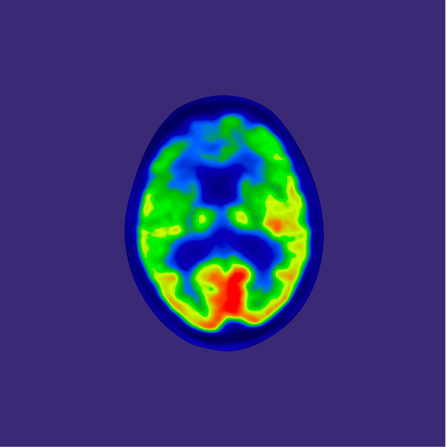 IRM fonctionnelle cérébrale