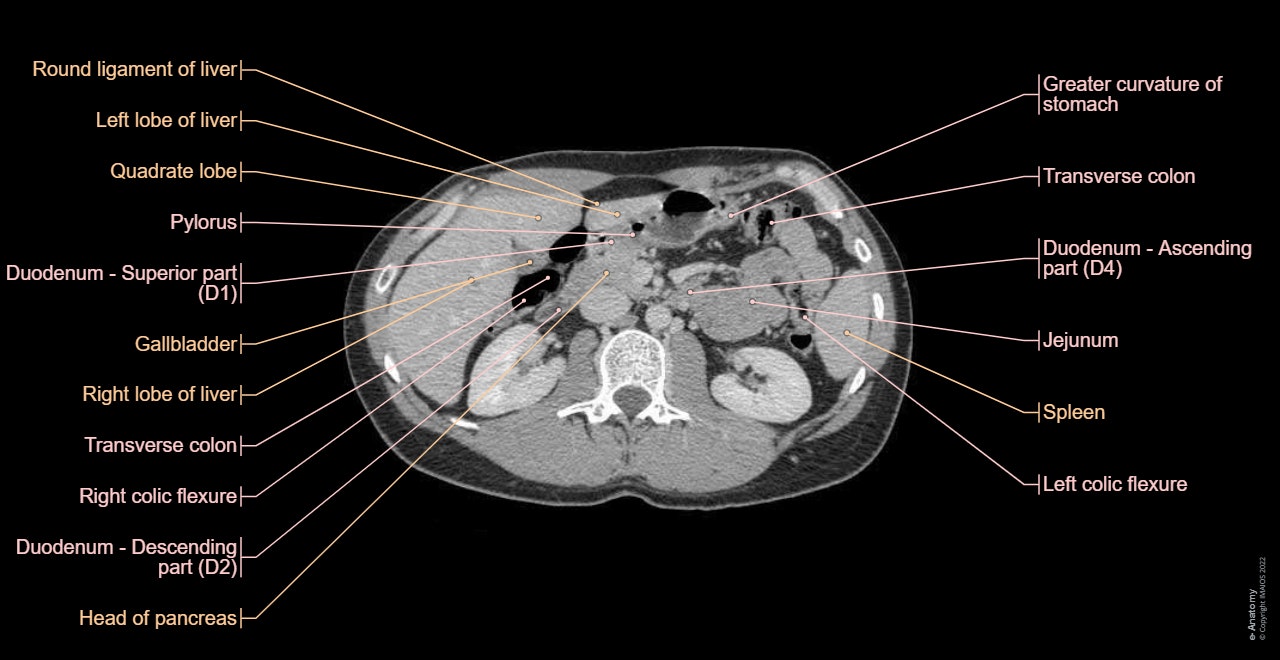 Segmental anatomy of the liver : hepatic segmentation with highlighted segments