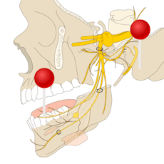 Cranial nerves Illustrations with pins